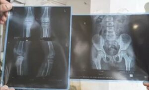 X-ray of student